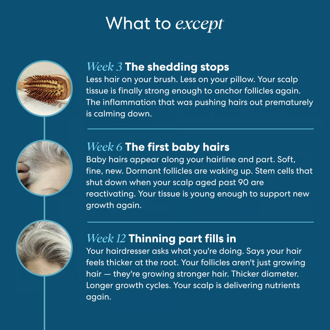 KilgourMD Dual-Action System To Stop Hair Loss In 6 Weeks