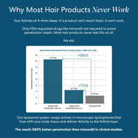 KilgourMD Dual-Action System To Stop Hair Loss In 6 Weeks